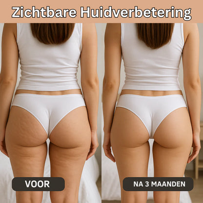 SculptFit™ 3D Compressielegging