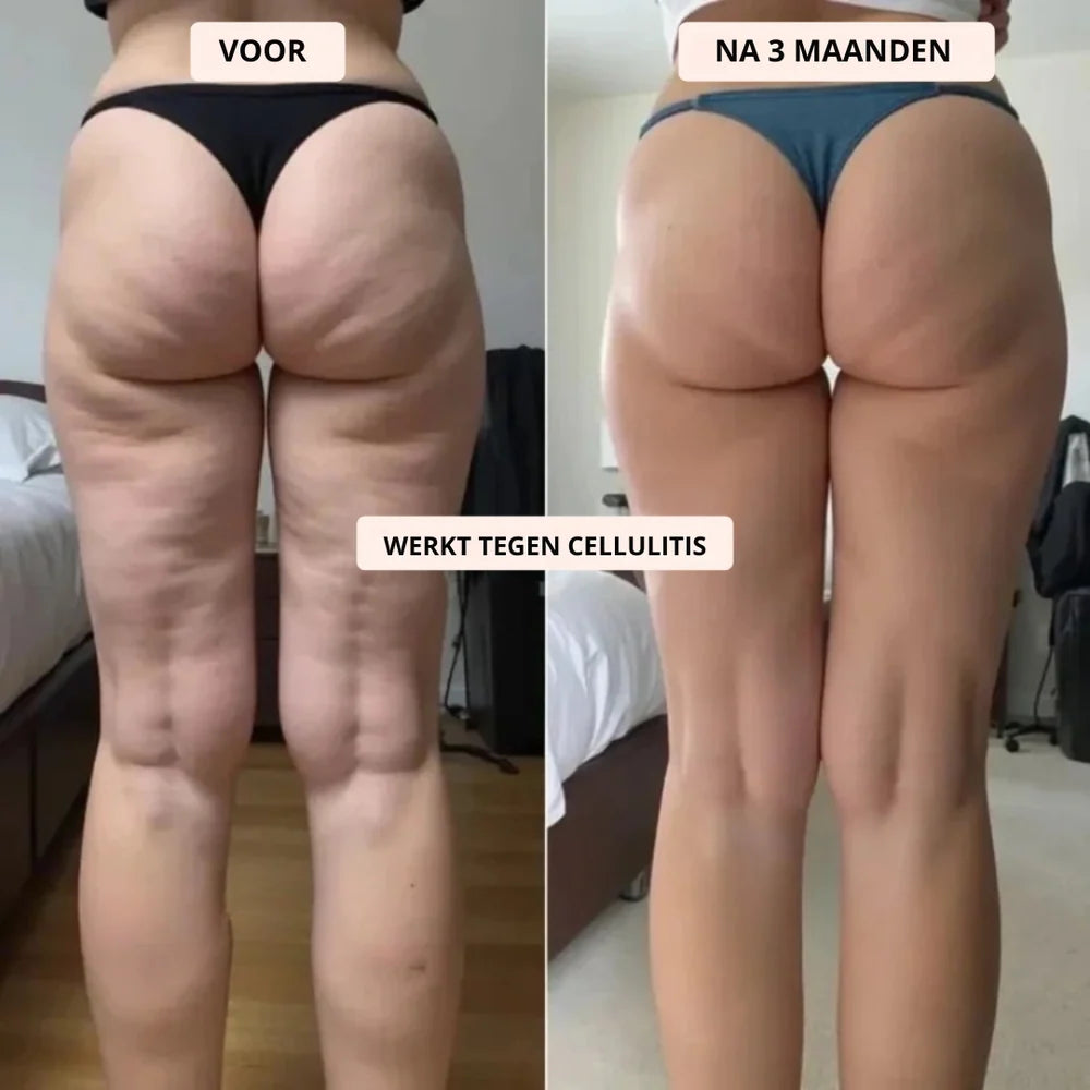 SculptFit™ 3D Compressielegging