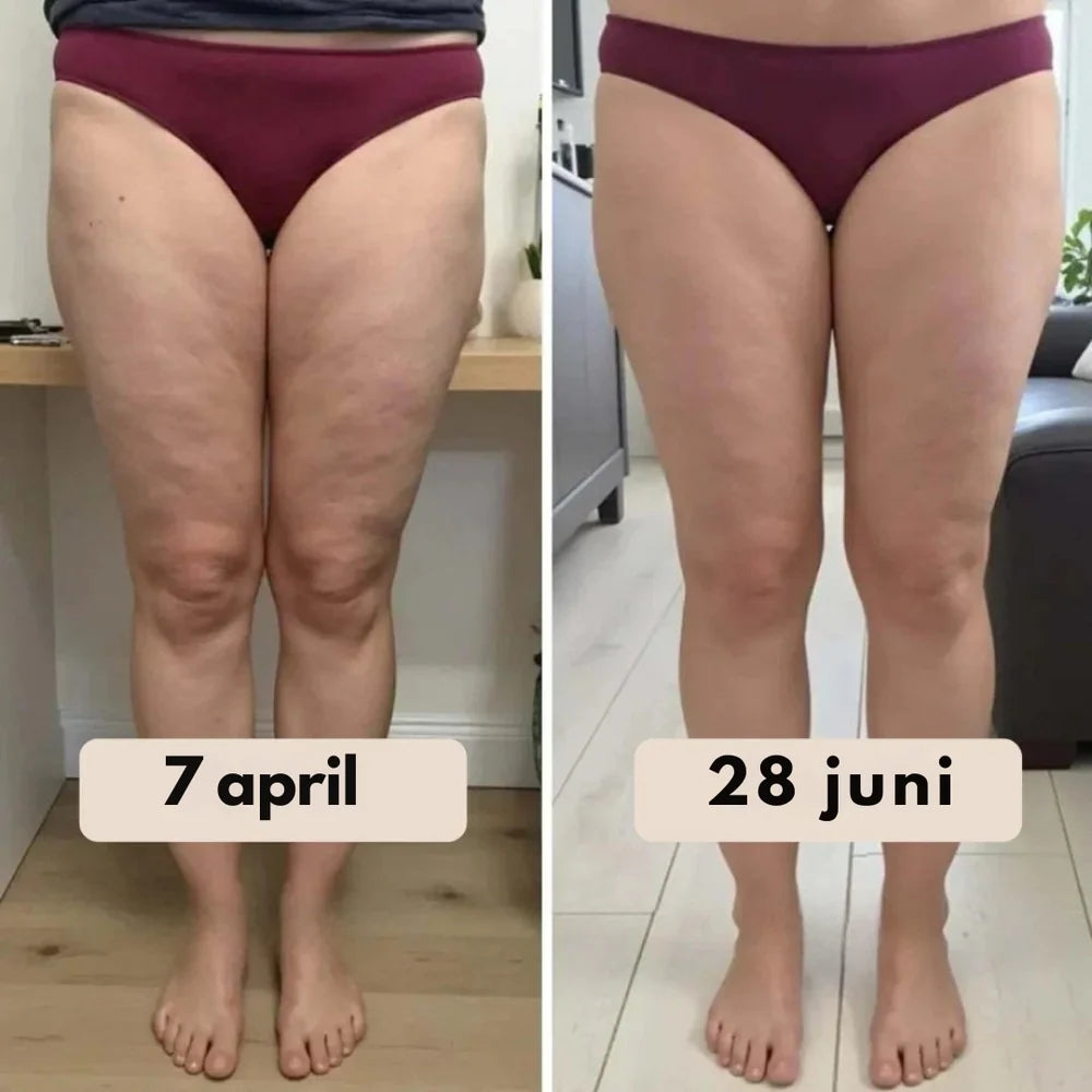 SculptFit™ 3D Compressielegging