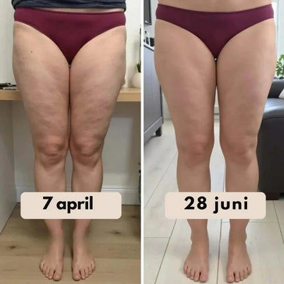 SculptFit™ 3D Compressielegging