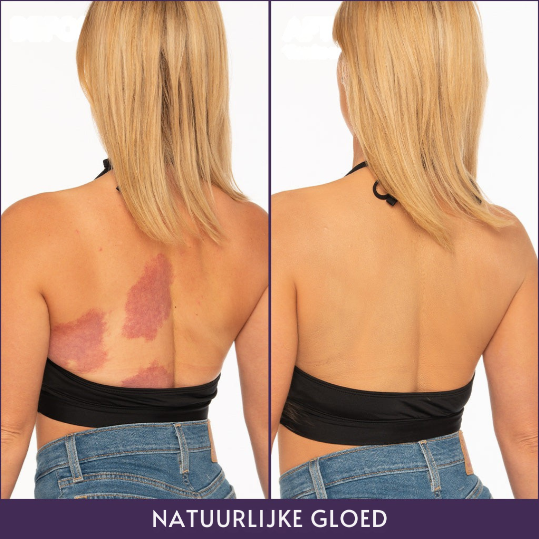 Lichaamperfector™ Foundation – Egale, zelfverzekerde huid