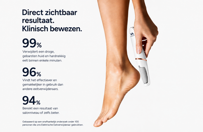 Velozia SmoothStep Pro – Elektrische Eeltverwijderaar voor Gladde en Zachte Voeten