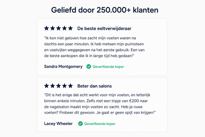 Velozia SmoothStep Pro – Elektrische Eeltverwijderaar voor Gladde en Zachte Voeten